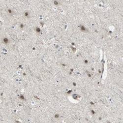 SCAP2 Antibody, Novus Biologicals 0.1mL; Unlabeled:Antibodies, Polyclonal
