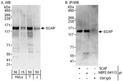 SCAP Antibody, Novus Biologicals 0.1mg; Unlabeled:Antibodies, Polyclonal