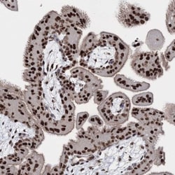 SCC112 Antibody, Novus Biologicals 0.1mL; Unlabeled:Antibodies, Polyclonal