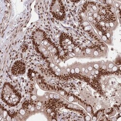 SCC112 Antibody, Novus Biologicals:Antibodies:Primary Antibodies