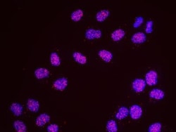 SCC112 Antibody, Novus Biologicals 0.1mL; Unlabeled:Antibodies, Polyclonal