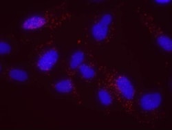 SCC112 Antibody, Novus Biologicals 0.1mL; Unlabeled:Antibodies, Polyclonal