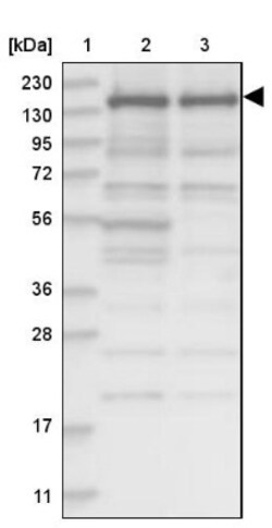 SCC112 Antibody, Novus Biologicals:Antibodies:Primary Antibodies