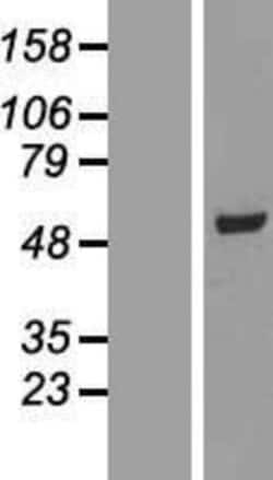 Novus Biologicals&trade;&nbsp;SCCPDH Overexpression Lysate