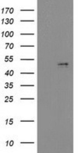 PDGF-D/SCDGFB Antibody (OTI1C1), Novus Biologicals 0.1mL; Unlabeled:Antibodies,