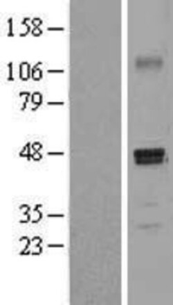 Novus Biologicals™ PDGF-D/SCDGFB Overexpression Lysate
