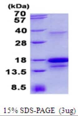 Novus Biologicals&trade;&nbsp;Recombinant Human PDGF-D/SCDGFB His Protein