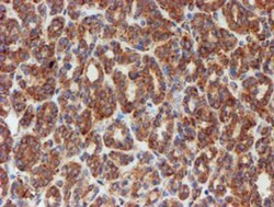 SCFD1 Antibody (OTI5G4), Novus Biologicals 0.1mL; Unlabeled:Antibodies,