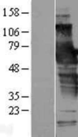 Novus Biologicals&trade;&nbsp;SCHIP1 Overexpression Lysate