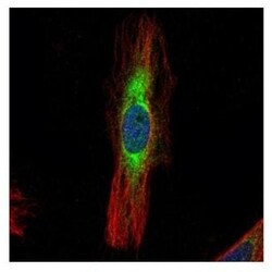 SCIN Antibody, Novus Biologicals 100 &mu;L | Buy Online | Novus Biologicals | Fisher Scientific
