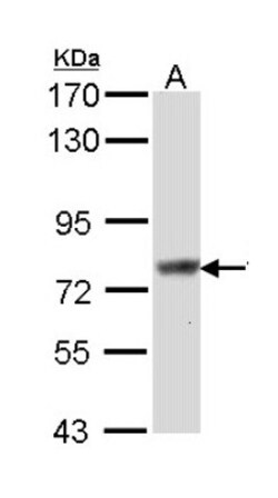 SCIN Antibody, Novus Biologicals 100 &mu;L | Buy Online | Novus Biologicals | Fisher Scientific