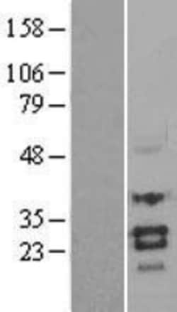 Novus Biologicals&trade;&nbsp;SOST/Sclerostin Overexpression Lysate