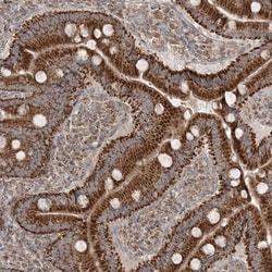 SCLT1 Antibody, Novus Biologicals 25 &mu;L, Unlabeled:Antibodies, Polyclonal