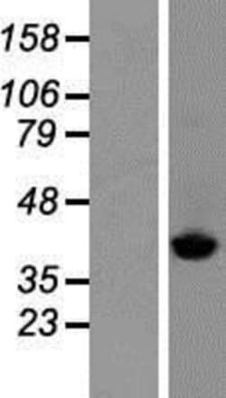 Novus Biologicals&trade;&nbsp;SCLY Overexpression Lysate