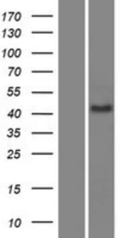 Novus Biologicals&trade;&nbsp;SCML4 Overexpression Lysate