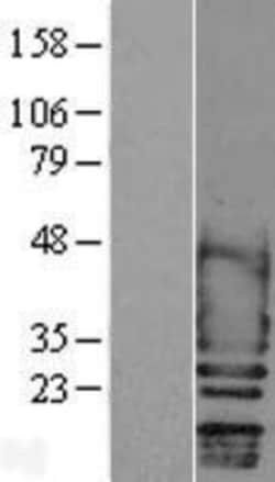 Novus Biologicals&trade;&nbsp;Scn2b Overexpression Lysate