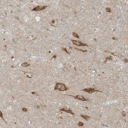 SCN3A Antibody, Novus Biologicals 0.1mL; Unlabeled:Antibodies, Polyclonal