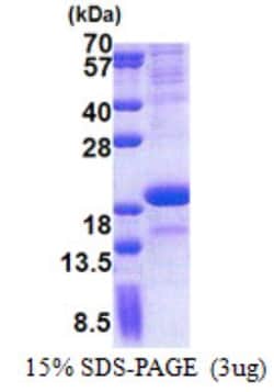Novus Biologicals&trade;&nbsp;Recombinant Human SCN3B His Protein