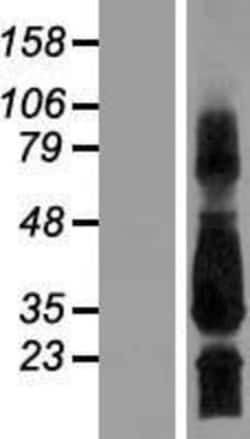 Novus Biologicals™ SCN4B Overexpression Lysate