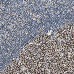 SCN7A Antibody, Novus Biologicals:Antibodies:Primary Antibodies