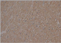 SCN7A Antibody, Novus Biologicals 0.2mL; Unlabeled:Antibodies, Polyclonal