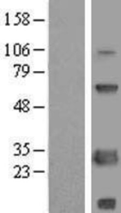 Novus Biologicals&trade;&nbsp;SCNM1 Overexpression Lysate