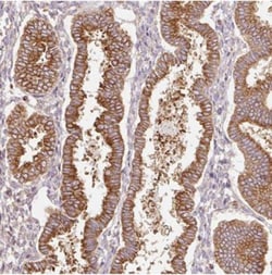 SCNM1 Antibody, Novus Biologicals 0.1mL; Unlabeled:Antibodies, Polyclonal
