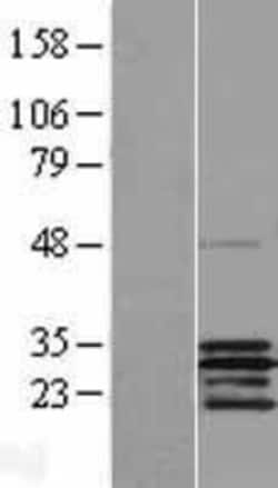 Novus Biologicals&trade;&nbsp;SCO2 Overexpression Lysate