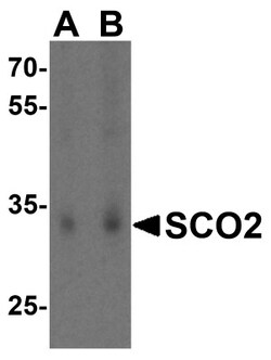 SCO2 Antibody - BSA Free, Novus Biologicals 0.1mg; Unlabeled:Antibodies,