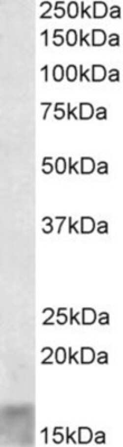 SCOC Antibody, Novus Biologicals 0.1mg; Unlabeled:Antibodies, Polyclonal
