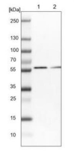 Sterol carrier protein 2 Antibody, Novus Biologicals 25 &mu;L; Unlabeled:Antibodies,