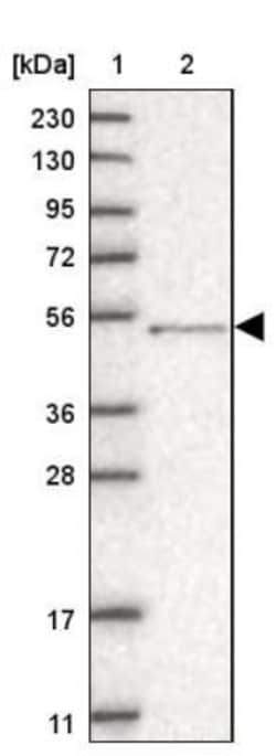 Sterol carrier protein 2 Antibody, Novus Biologicals 0.1mL; Unlabeled:Antibodies,