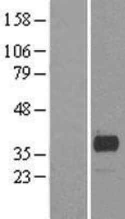 Novus Biologicals™ Phospholipid Scramblase 1/PLSCR1 Overexpression Lysate