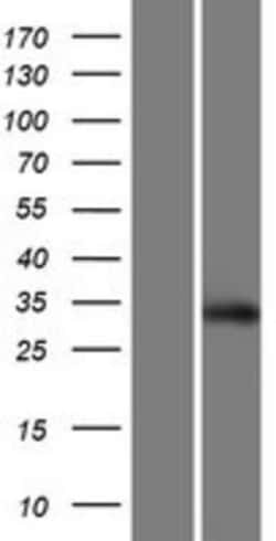 Novus Biologicals&trade;&nbsp;SCRT2 Overexpression Lysate
