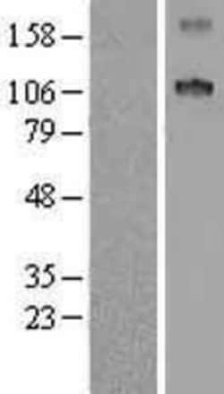 Novus Biologicals™ SCUBE1 Overexpression Lysate