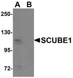 SCUBE1 Antibody - BSA Free, Novus Biologicals 0.1mg; Unlabeled:Antibodies,