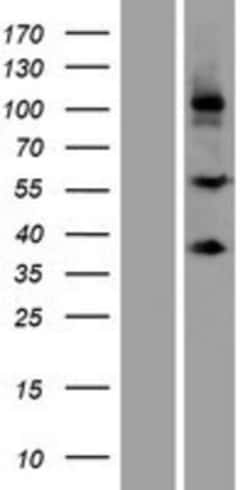 Novus Biologicals&trade;&nbsp;SCUBE3 Overexpression Lysate