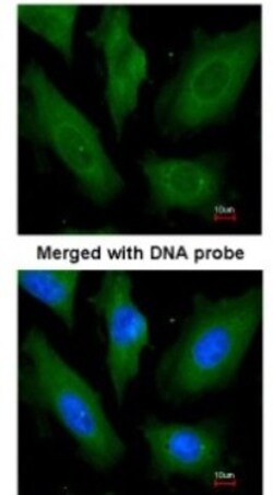 SCY1 like 3 Antibody, Novus Biologicals 0.1mg; Unlabeled:Antibodies, Polyclonal