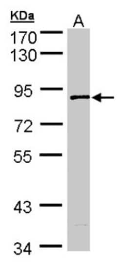 SCY1 like 3 Antibody, Novus Biologicals 0.1mg; Unlabeled:Antibodies, Polyclonal