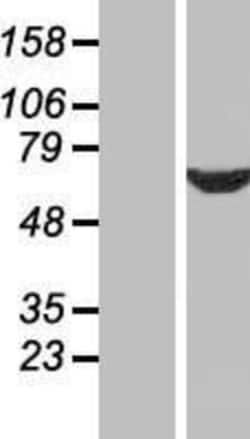 Novus Biologicals&trade;&nbsp;SDCCAG10 Overexpression Lysate