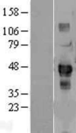 Novus Biologicals&trade;&nbsp;SDCCAG3 Overexpression Lysate