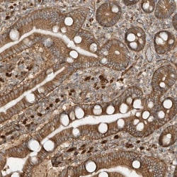 SDCCAG3 Antibody, Novus Biologicals 0.1mL; Unlabeled:Antibodies, Polyclonal