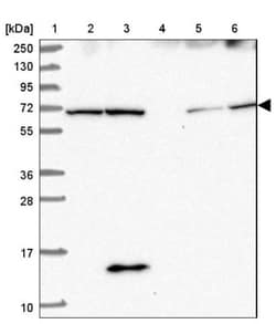 SDCCAG8 Antibody, Novus Biologicals 0.1mL; Unlabeled:Antibodies, Polyclonal