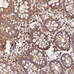 SDCCAG8 Antibody, Novus Biologicals 0.1mL; Unlabeled:Antibodies, Polyclonal