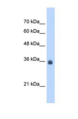 SDF4 Antibody, Novus Biologicals 100 &mu;L | Buy Online | Novus Biologicals | Fisher Scientific