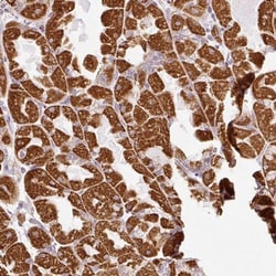 SDHA Antibody, Novus Biologicals 0.1mL; Unlabeled:Antibodies, Polyclonal