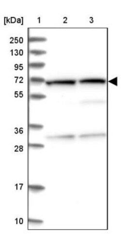 SDHA Antibody, Novus Biologicals 0.1mL; Unlabeled:Antibodies, Polyclonal