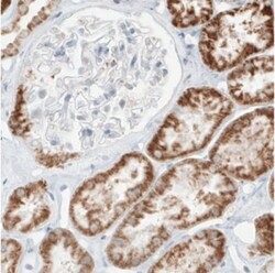 SDHB Antibody (CL0346), Novus Biologicals 25 &mu;L, Unlabeled:Antibodies,