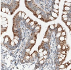 SDHB Antibody (CL0346), Novus Biologicals 25 &mu;L, Unlabeled:Antibodies,