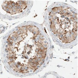 SDHB Antibody (CL0346), Novus Biologicals 25 &mu;L, Unlabeled:Antibodies,
